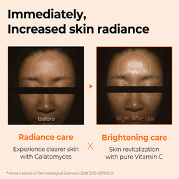 Some By Mi Galactomyces Pure Vitamin C Glow Serum 30ml