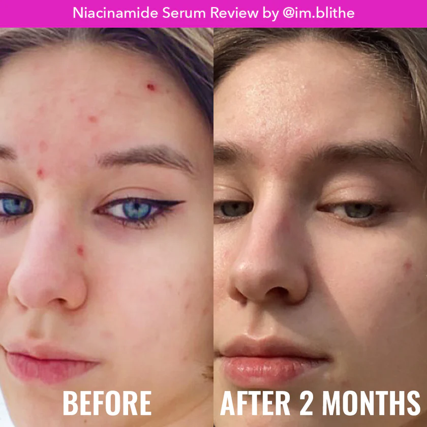 Good Molecules Niacinamide Serum_2
