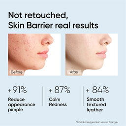 Skintific 5X Ceramide Barrier Repair Moisturize Gel
