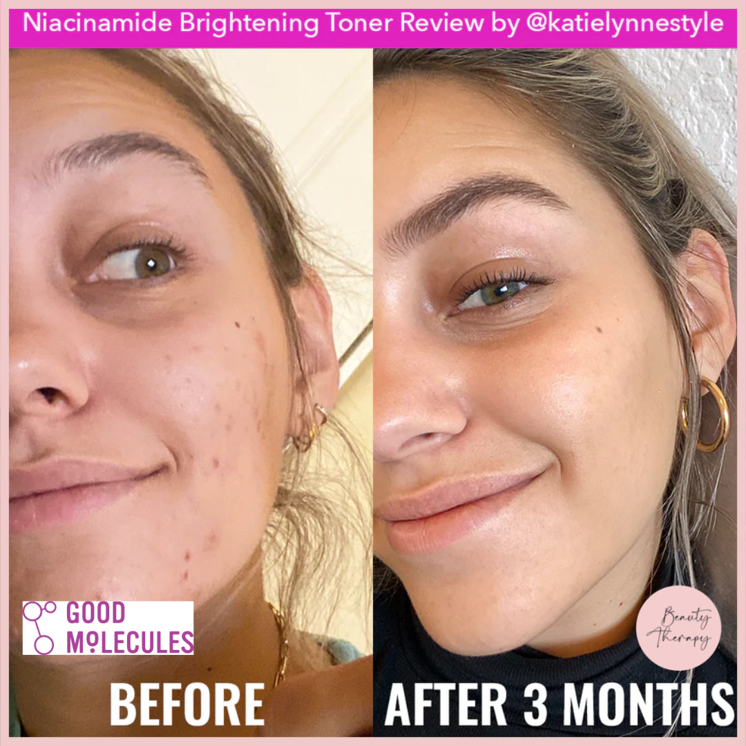 Good Molecules Niacinamide Brightening Toner_3