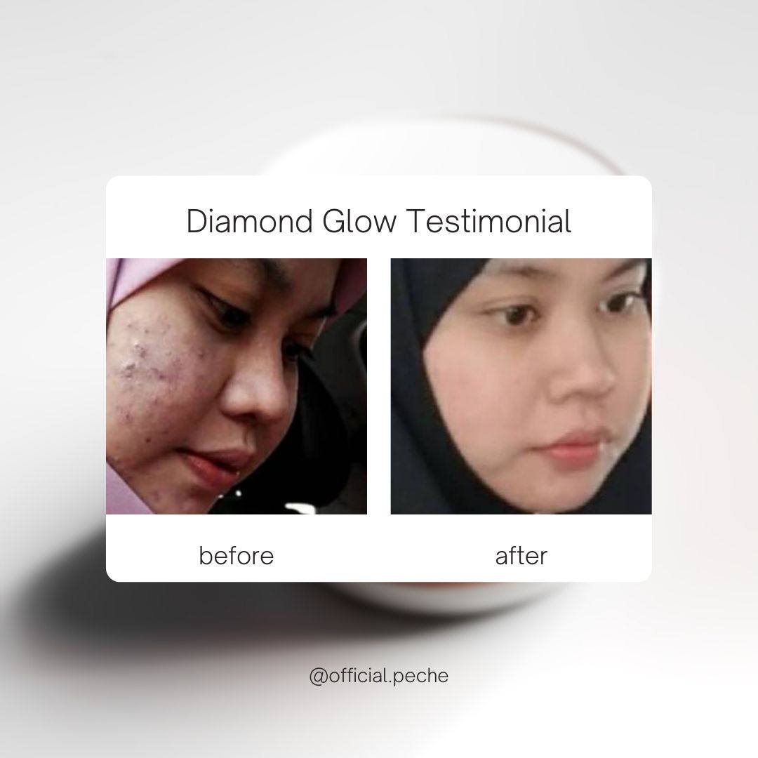 Diamond Glow (SkinSupplement)_11
